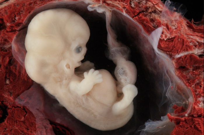 Stunning Photos Show Dignity of Human Life in Very Early Stages